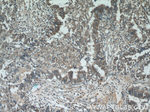 ZFP36 Antibody in Immunohistochemistry (Paraffin) (IHC (P))