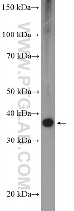 ZFP36 Antibody in Western Blot (WB)