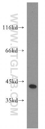 ZFP36 Antibody in Western Blot (WB)