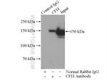 Complement factor H Antibody in Immunoprecipitation (IP)