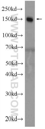 Complement factor H Antibody in Western Blot (WB)