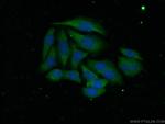 ADAMTS1 Antibody in Immunocytochemistry (ICC/IF)