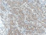 ADAMTS1 Antibody in Immunohistochemistry (Paraffin) (IHC (P))