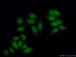 IMP3 Antibody in Immunocytochemistry (ICC/IF)