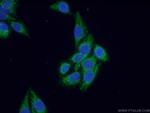 SEC5/EXOC2 Antibody in Immunocytochemistry (ICC/IF)