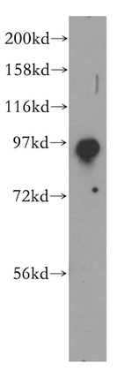 SEC5/EXOC2 Antibody in Western Blot (WB)