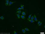 DPP8 Antibody in Immunocytochemistry (ICC/IF)