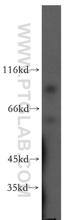 DPP8 Antibody in Western Blot (WB)