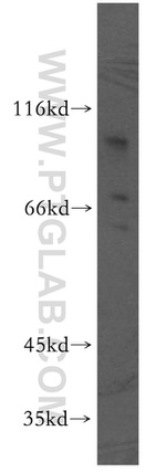 DPP8 Antibody in Western Blot (WB)