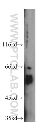 FOXG1 Antibody in Western Blot (WB)