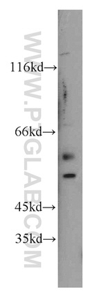 FOXG1 Antibody in Western Blot (WB)