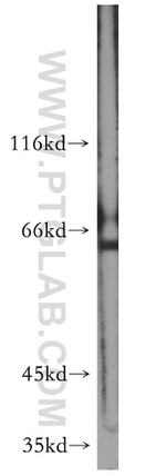 FOXG1 Antibody in Western Blot (WB)