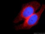 IFITM2 Antibody in Immunocytochemistry (ICC/IF)