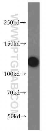 CP110 Antibody in Western Blot (WB)