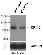 CP110 Antibody in Western Blot (WB)