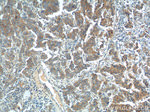 CP110 Antibody in Immunohistochemistry (Paraffin) (IHC (P))