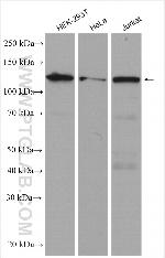 CP110 Antibody in Western Blot (WB)