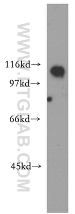 CP110 Antibody in Western Blot (WB)