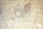 CBLB Antibody in Immunohistochemistry (Paraffin) (IHC (P))