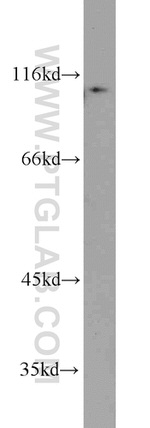 CBLB Antibody in Western Blot (WB)