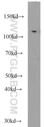 CBLB Antibody in Western Blot (WB)