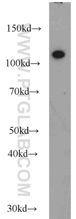 CBLB Antibody in Western Blot (WB)