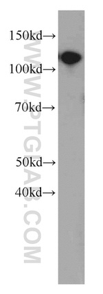 CBLB Antibody in Western Blot (WB)