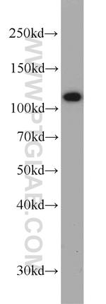 CBLB Antibody in Western Blot (WB)