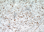 BCL2 Antibody in Immunohistochemistry (Paraffin) (IHC (P))