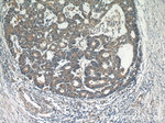 BCL2 Antibody in Immunohistochemistry (Paraffin) (IHC (P))