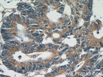 BCL2 Antibody in Immunohistochemistry (Paraffin) (IHC (P))