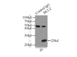 BCL2 Antibody in Immunoprecipitation (IP)