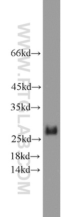 BCL2 Antibody in Western Blot (WB)