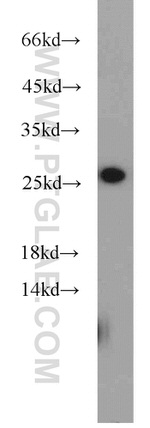 BCL2 Antibody in Western Blot (WB)