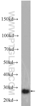 BCL2 Antibody in Western Blot (WB)