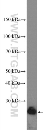 BCL2 Antibody in Western Blot (WB)