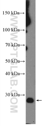 BCL2 Antibody in Western Blot (WB)