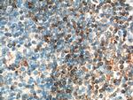 BCL2 Antibody in Immunohistochemistry (Paraffin) (IHC (P))