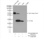 BCL2 Antibody in Immunoprecipitation (IP)