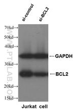 BCL2 Antibody in Western Blot (WB)