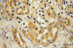 MOBKL1A Antibody in Immunohistochemistry (Paraffin) (IHC (P))