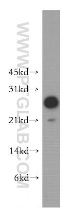 MOBKL1A Antibody in Western Blot (WB)