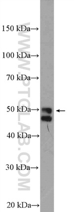 SRFBP1 Antibody in Western Blot (WB)