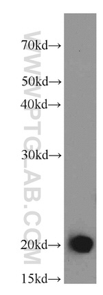 Centrin 1 Antibody in Western Blot (WB)