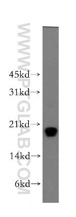 Centrin 1 Antibody in Western Blot (WB)