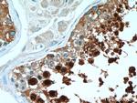 HSPA2 Antibody in Immunohistochemistry (Paraffin) (IHC (P))