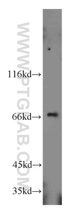 HSPA2 Antibody in Western Blot (WB)