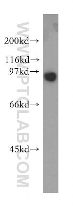 SECISBP2 Antibody in Western Blot (WB)