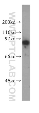 SECISBP2 Antibody in Western Blot (WB)