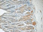 SMAP1 Antibody in Immunohistochemistry (Paraffin) (IHC (P))